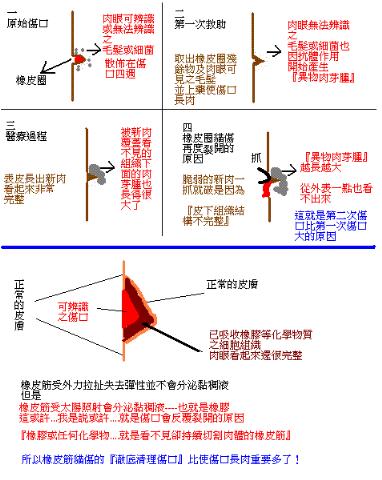 附加檔案: 30_2513_93.gif